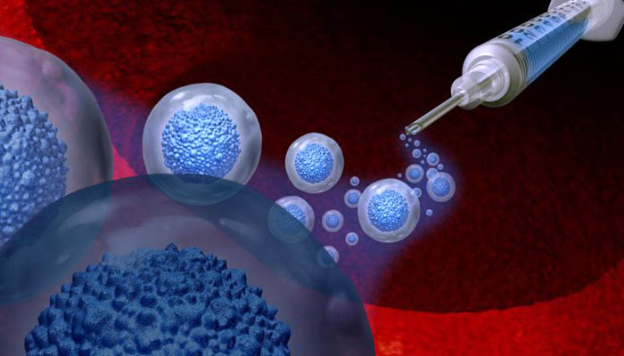 Stem Cell Transplant: A Possible Cure for HIV
